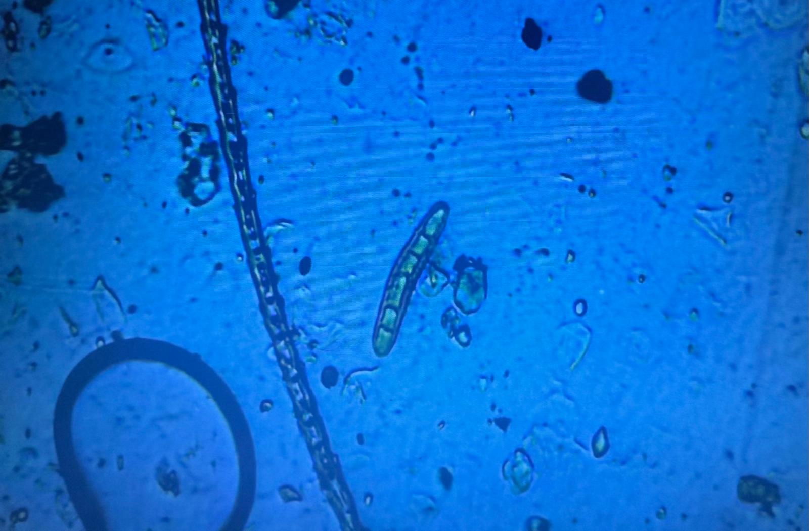 Microscopio / Macroconidio M.canis